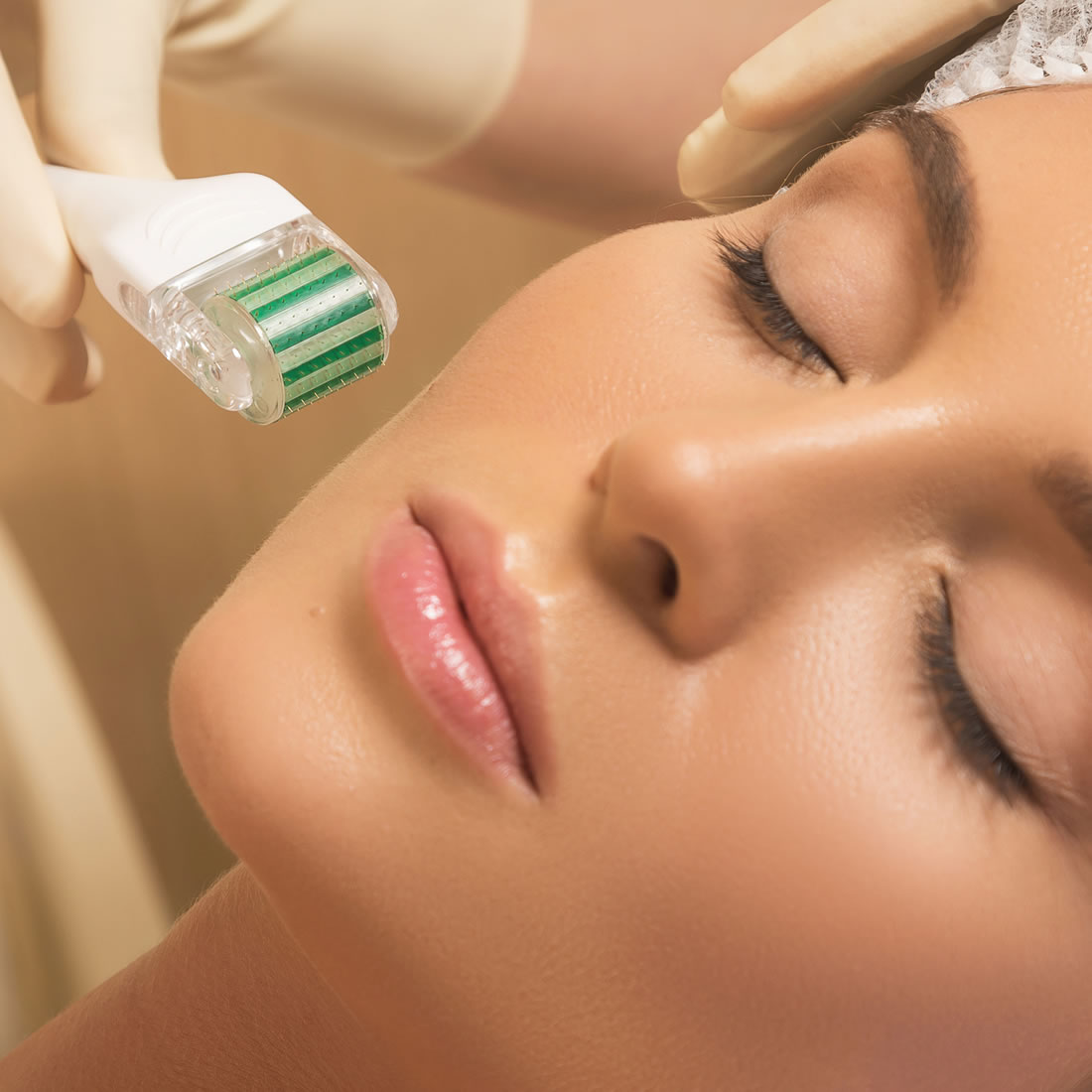 MicroNeedling Facial by African Heart